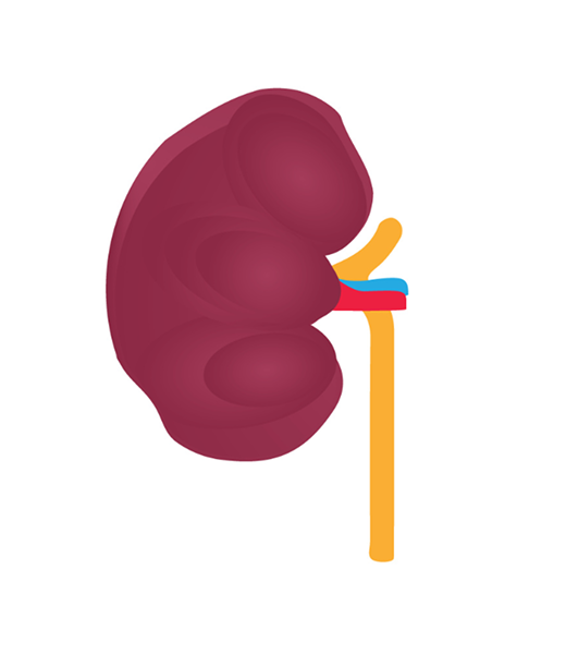 Kidney Stage 3 Image Kidney Stage 3 Image